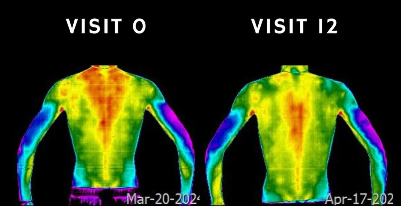 Visit 0 to 12